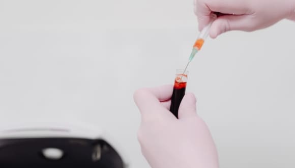 Prema Health Now Offering the Galleri Cancer Blood Test - A Groundbreaking Screening Option in Portsmouth